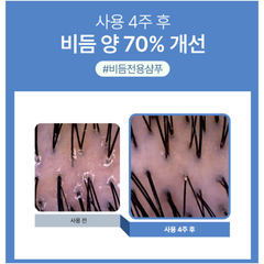 MINOXELL DANDRUFF SCALP COOLING Shampoo 480ml * 3ea
