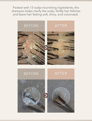 107 Scalp Purifying Microbiome Shampoo (2025 Renewal)