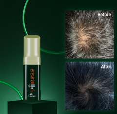 MINOXELL SCALP INTENSIVE AMPOULE 60m, 3ea