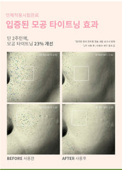 AXIS-Y Calamine Pore Control Capsule Serum