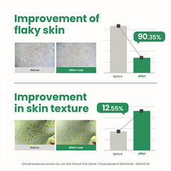 AXIS-Y PHA Resurfacing Glow Peel