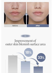 AXIS-Y TXA 2.5% Intensive Brightening Cream