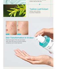 Anua BHA 2% Gentle Exfoliating Toner 150ml