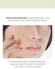 Anua Green Lemon Vita C Serum