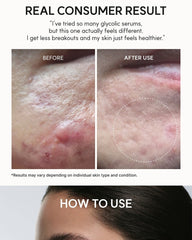 Arencia Eraser Shot Glycolic Acid Booster