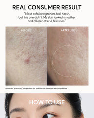 Arencia Eraser Shot Glycolic Acid Exfoliator
