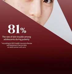 Ariul Expert Azelaic Acid 5% Ampoule