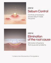 Ariul Expert Azelaic Acid 5% Ampoule