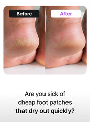 BAREN Shea Butter Sleeping Heel Patch (6 Patches / 3 Pairs)