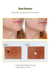 By Wishtrend Sulfur 3% Clean Gel 30g
