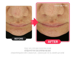 DR.G R.E.D Blemish Clear Hyal Cica Soothing Serum 50ml