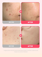 Dr.G R.E.D Blemish Repair Soothing Cream 50ml