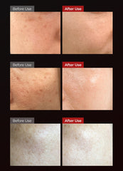 Dr.Melaxin Astaxanthin Anti-Freckles & Whitening Capsule Cream 50g
