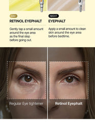 Dr.Melaxin Retinol Eyephalt Eyebag Cream 10g