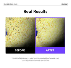 FRANKLY Closer Mask (10 Sheets)