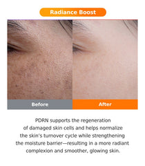 FRANKLY PDRN Bounce Ball Serum 30ml