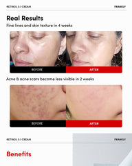 FRANKLY Retinol 0.1% Cream 30ml