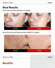 FRANKLY Retinol 0.3% Cream 20ml
