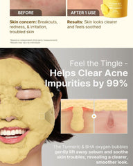 P.CALM Turmeric Bubble Deep Mask 90g