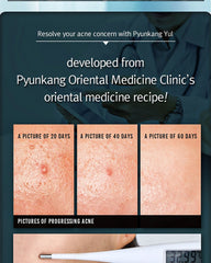 Pyunkang Yul ACNE Dressing Mask Pack 5 masks