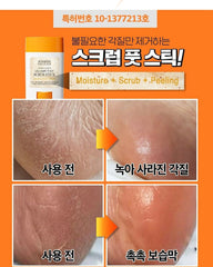 Sungboon Editor LHA Baby Foot Scrub Stick 20g