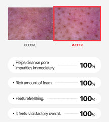 WJ A.Cneed Blemish Red Foam Cleanser 120ml