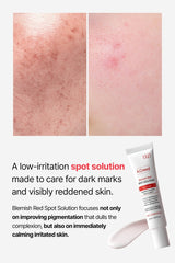 WJ A.Cneed Blemish Red Spot Solution 20ml