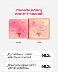 WJ A.Cneed Blemish Red Spot Solution 20ml