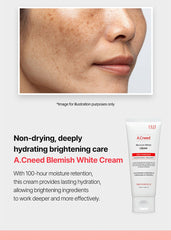 WJ A.Cneed Blemish White Cream 100ml