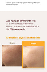 WJ EGFon Derma Clinic Ampoule 30ml
