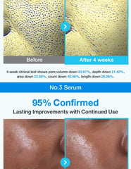 numbuzin No.3 Blue Bio-Retinol Pore Refining Serum 1.3ml × 10 1.3ml x 10